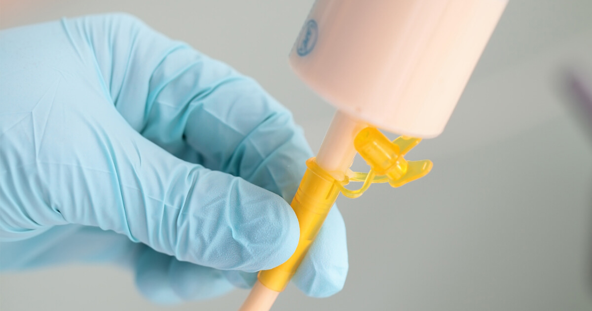 ให้อาหารทางสายยาง วันละ กี่ มื้อ